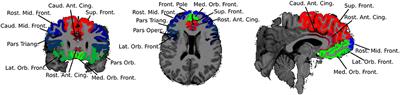 Cerebellar and Prefrontal Structures Associated With Executive Functioning in Pediatric Patients With Congenital Heart Defects